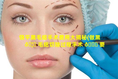 饶平黑毛痣手术费用大揭秘(做黑 🦟 毛痣切除过程手术 🐒 要住院多少天)